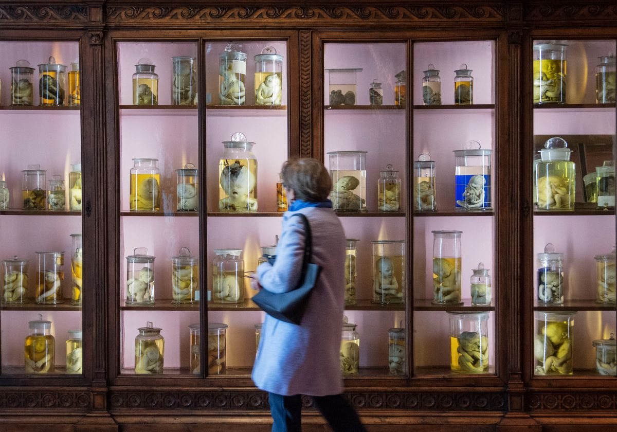 Best Things To Do In Naples – MUSA Anatomy Museum